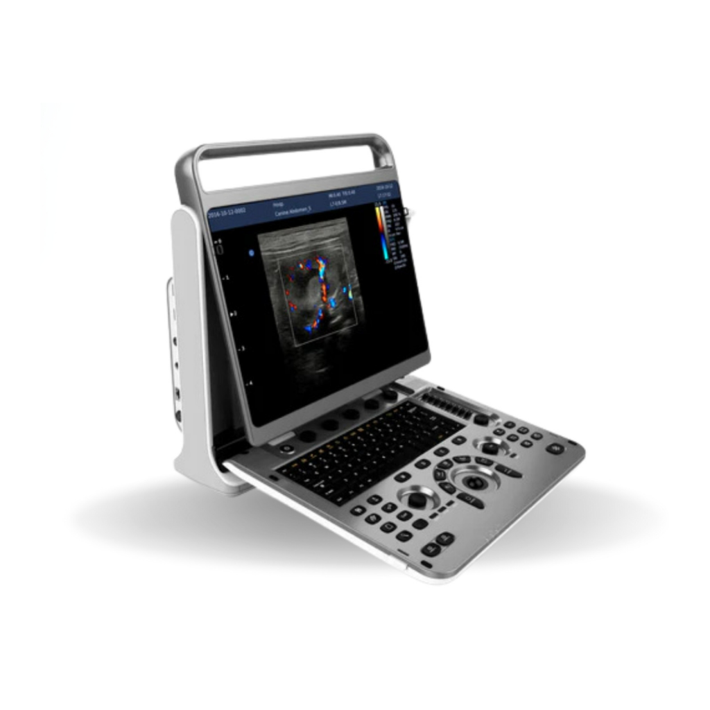 CHISON EBIT30 ULTRASON