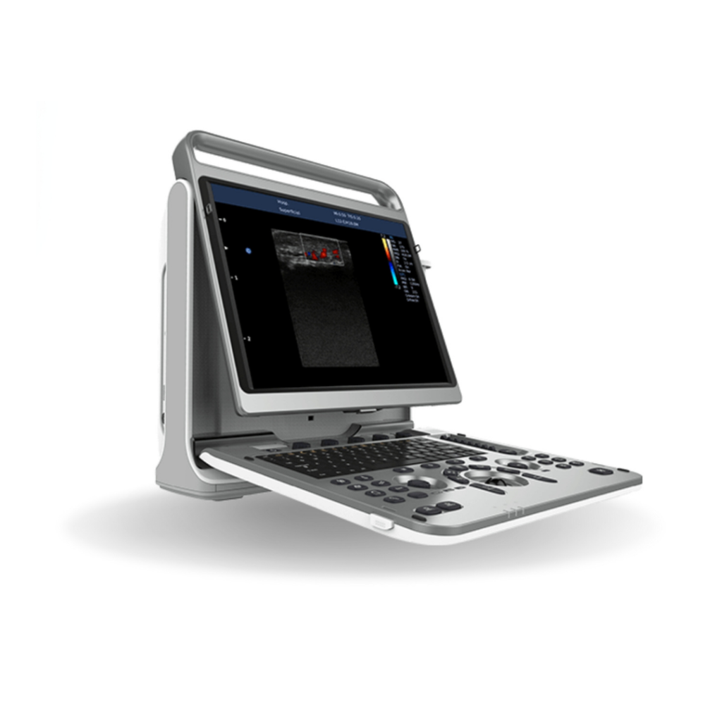 CHISON EBIT50 ULTRASON