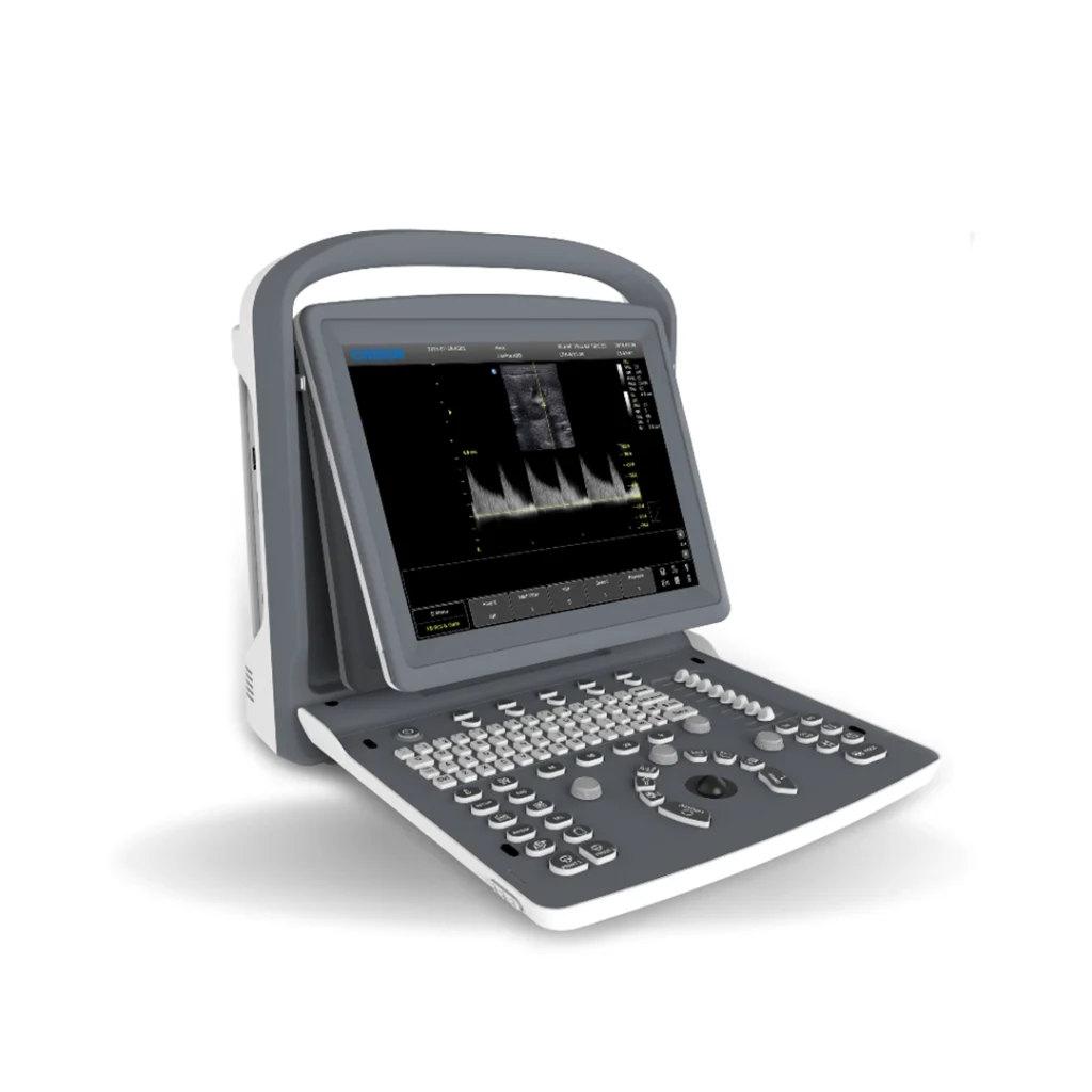 CHISON ECO 2 ULTRASON